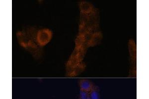 Immunofluorescence analysis of A-431 cells using RPL23A Polyclonal Antibody at dilution of 1:100. (RPL23A 抗体)