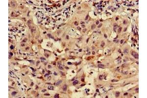 Immunohistochemistry (IHC) image for anti-Ribosomal Protein S15 (RPS15) (AA 63-137) antibody (ABIN7142496)