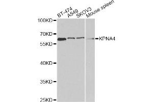 Western blot analysis of extracts of various cell lines, using KPNA4 antibody. (KPNA4 抗体)