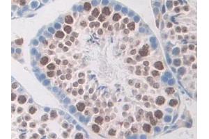 Immunohistochemistry (IHC) image for anti-Macrophage Stimulating 1 Receptor (C-Met-Related tyrosine Kinase) (MST1R) (AA 89-275) antibody (ABIN7440278)