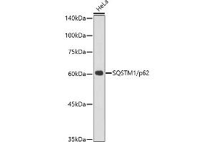 Western Blotting (WB) image for anti-Sequestosome 1 (SQSTM1) antibody (ABIN7270205)