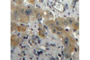 IHC-P analysis of Liver tissue, with DAB staining. (PLGF 抗体  (AA 43-162))