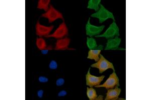ABIN6257782 and ABIN6275437 staining Hela cells(45 min of heat-shock) by IF/ICC. (Rabenosyn 5 抗体  (Internal Region))