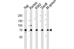 Western blot analysis of lysates from Raji, Ramos, K562, Daudi cell line and mouse spleen tissue lysate(from left to right), using BTK Antibody (Center) (ABIN6243554 and ABIN6577451). (BTK 抗体  (AA 396-430))