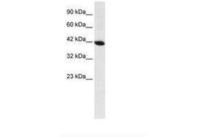 Image no. 1 for anti-Homeobox A13 (HOXA13) (AA 80-129) antibody (ABIN6735847) (HOXA13 抗体  (AA 80-129))