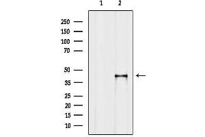 Western blot analysis of lysates from F10, using ARPC1A Antibody.