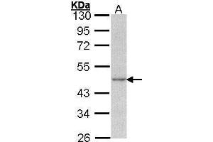 WB Image Sample (30 ug of whole cell lysate) A: A431 , 10% SDS PAGE antibody diluted at 1:1000 (Actin, gamma 1 抗体  (N-Term))