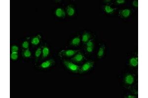 Immunofluorescent analysis of A549 cells using ABIN7176092 at dilution of 1:100 and Alexa Fluor 488-congugated AffiniPure Goat Anti-Rabbit IgG(H+L) (ZMYM3 抗体  (AA 1-495))