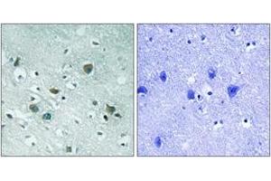Immunohistochemistry analysis of paraffin-embedded human brain, using CRMP-2 (Phospho-Thr509) Antibody. (DPYSL2 抗体  (pThr509))