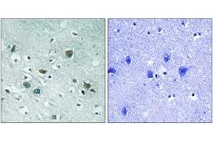 Immunohistochemistry analysis of paraffin-embedded human brain, using CRMP-2 (Phospho-Thr509) Antibody.