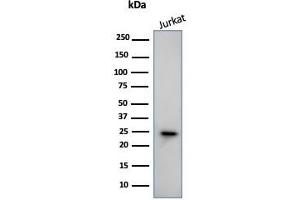 Western Blot Analysis of human Jurkat Cell lysate using CD3e Mouse Monoclonal Antibody (PC3/188A). (CD3 epsilon 抗体  (Cytoplasmic Domain))