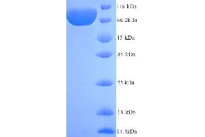 SDS-PAGE (SDS) image for Vascular Cell Adhesion Molecule 1 (VCAM1) (AA 25-698), (Extracellular) protein (His tag) (ABIN5713934)