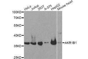 Western blot analysis of extracts of various cell lines, using AKR1B1 antibody. (AKR1B1 抗体  (AA 1-316))