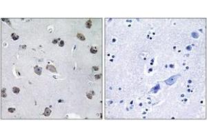 Immunohistochemistry (IHC) image for anti-TNF Receptor-Associated Factor 3 Interacting Protein 1 (TRAF3IP1) (AA 221-270) antibody (ABIN1534467)