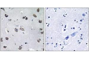 Immunohistochemistry analysis of paraffin-embedded human brain tissue, using MIPT3 Antibody. (TRAF3IP1 抗体  (AA 221-270))