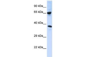 Western Blotting (WB) image for anti-Chromosome 6 Open Reading Frame 134 (C6orf134) antibody (ABIN2458677) (Chromosome 6 Open Reading Frame 134 (C6orf134) 抗体)