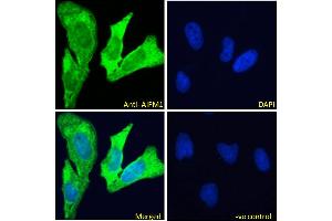 ABIN5893605-P1 Immunofluorescence analysis of paraformaldehyde fixed HeLa cells, permeabilised with 0. (AIF 抗体)
