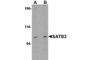 Image no. 1 for anti-SATB Homeobox 2 (SATB2) (N-Term) antibody (ABIN1494405) (SATB2 抗体  (N-Term))