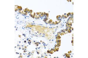 Immunohistochemistry of paraffin-embedded mouse lung using WNT9A antibody. (WNT9A 抗体)