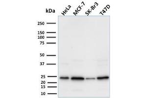 Western Blot Analysis using Mouse Mammaglobin-Monospecific Monoclonal Antibody (MGB1/2000). (Mammaglobin A 抗体)