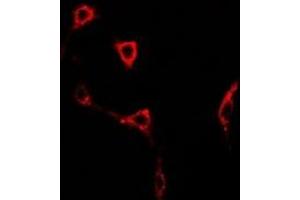 Immunofluorescent analysis of GLUR6 staining in U2OS cells. (GRIK2 抗体)
