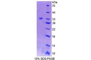 SDS-PAGE analysis of Mouse PTPN5 Protein.