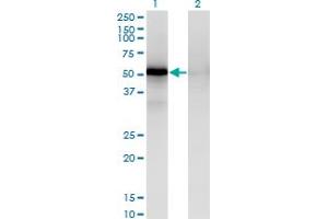 Western Blot analysis of MAPKAPK5 expression in transfected 293T cell line by MAPKAPK5 monoclonal antibody (M02), clone 3D7.