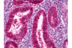Anti-PCK1 antibody IHC of human uterus, endometrium. (PCK1 抗体)