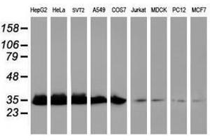 Image no. 10 for anti-Exosome Component 7 (EXOSC7) antibody (ABIN1498140)