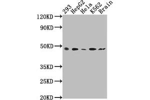 Western Blot Positive WB detected in: 293 whole cell lysate, HepG2 whole cell lysate, Hela whole cell lysate, K562 whole cell lysate, Rat brain tissue All lanes: FNTB antibody at 1:2000 Secondary Goat polyclonal to rabbit IgG at 1/50000 dilution Predicted band size: 49, 44 kDa Observed band size: 49 kDa (Recombinant FNTB 抗体)