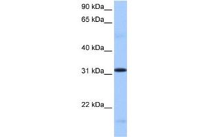 WB Suggested Anti-FUSIP1 Antibody Titration:  0. (SRSF10 抗体  (C-Term))