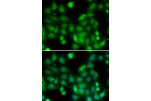 Immunofluorescence analysis of MCF-7 cells using RORA antibody (ABIN5974193).
