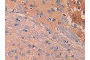 DAB staining on IHC-P; Samples: Mouse Cerebrum Tissue (IL13 Receptor alpha 1 抗体  (AA 28-171))