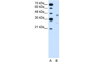 WB Suggested Anti-GPR161 Antibody Titration:  0. (GPR161 抗体  (Middle Region))