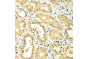 Immunohistochemistry of paraffin-embedded human kidney using RPS6KL1 antibody (ABIN5975299) at dilution of 1/100 (40x lens). (RPS6KL1 抗体)