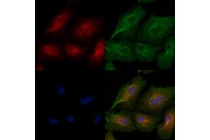 ABIN6259051 and ABIN6274992 staining  cells by IF/ICC. (Cep76 抗体  (Internal Region))