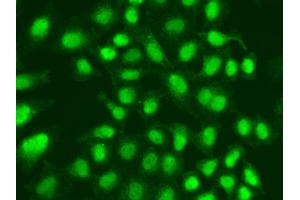Immunofluorescence analysis of A549 cell using APTX antibody. (Aprataxin 抗体)