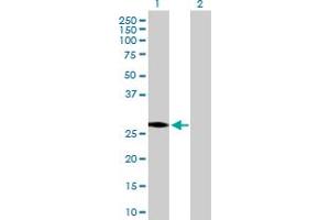 Western Blot analysis of HSD17B3 expression in transfected 293T cell line by HSD17B3 MaxPab polyclonal antibody. (HSD17B3 抗体  (AA 1-310))