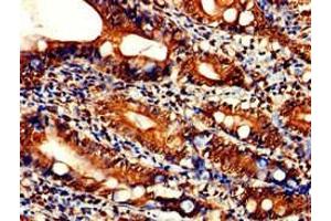 Immunohistochemistry of paraffin-embedded human small intestine tissue using ABIN7169201 at dilution of 1:100 (TLK2 抗体  (AA 23-234))
