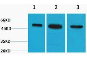 Western Blotting (WB) image for anti-Tubulin, beta 2A (TUBB2A) antibody (ABIN3178773) (TUBB2A 抗体)