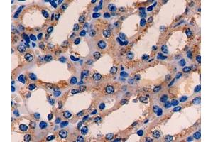 DAB staining on IHC-P; Samples: Mouse Kidney Tissue (ETFA 抗体  (AA 34-295))