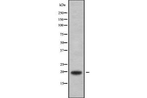Western blot analysis of MYLPF using HepG2 whole cell lysates (MYLPF 抗体  (C-Term))