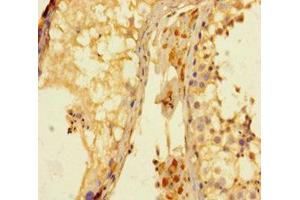 Immunohistochemistry of paraffin-embedded human testis tissue using ABIN7158695 at dilution of 1:100 (KDM4A 抗体  (AA 127-364))