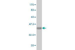 Western Blot detection against Immunogen (36. (MGAT3 抗体  (AA 430-531))