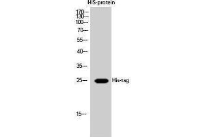 Western Blotting (WB) image for anti-His Tag antibody (ABIN3180426)