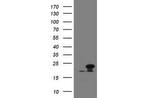 Image no. 2 for anti-NADH Dehydrogenase (Ubiquinone) 1 beta Subcomplex, 10, 22kDa (NDUFB10) antibody (ABIN1499668) (NDUFB10 抗体)