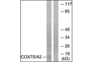 Western blot analysis of extracts from rat heart cells, using COX7S/A2 Antibody. (COX7A2 抗体  (N-Term))