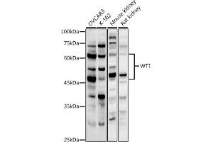 Western blot analysis of extracts of various cell lines, using WT1 antibody (ABIN3021697, ABIN3021698, ABIN3021699, ABIN1513692 and ABIN6215537) at 1:1000 dilution. (WT1 抗体  (AA 1-302))