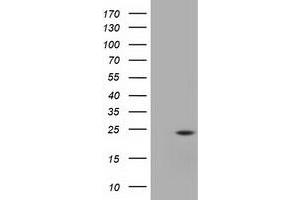 Western Blotting (WB) image for anti-Ubiquitin-Conjugating Enzyme E2T (Ube2t) antibody (ABIN1498764) (Ube2t 抗体)