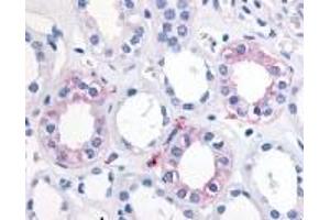 Immunohistochemistry (IHC) image for anti-Epoxide Hydrolase 2, Cytoplasmic (EPHX2) (Internal Region) antibody (ABIN2469511) (EPHX2 抗体  (Internal Region))